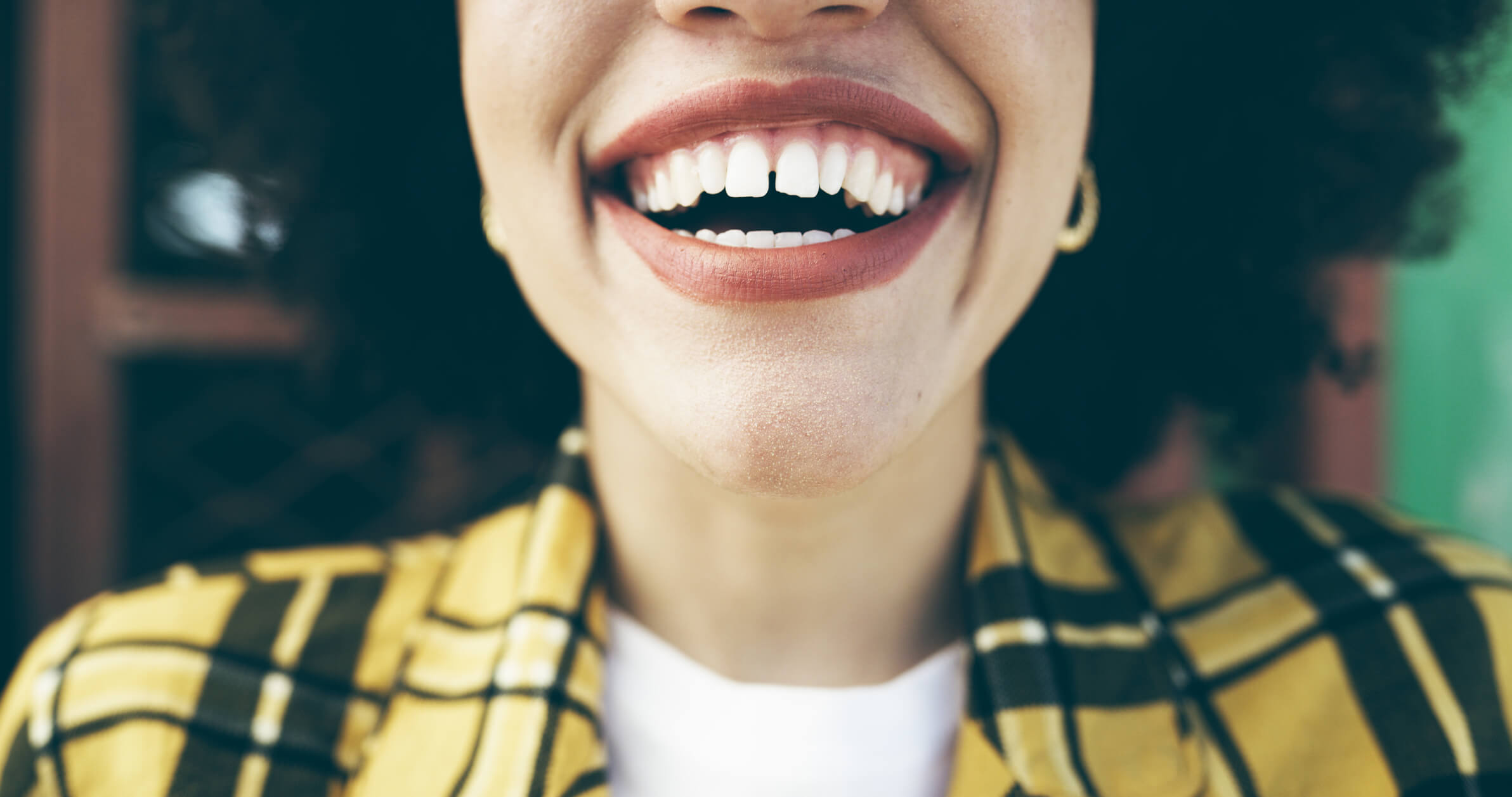 foto de mulher com diastema sorrindo representando sonhar com dentes